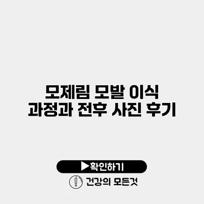 모제림 모발 이식 과정과 전후 사진 후기